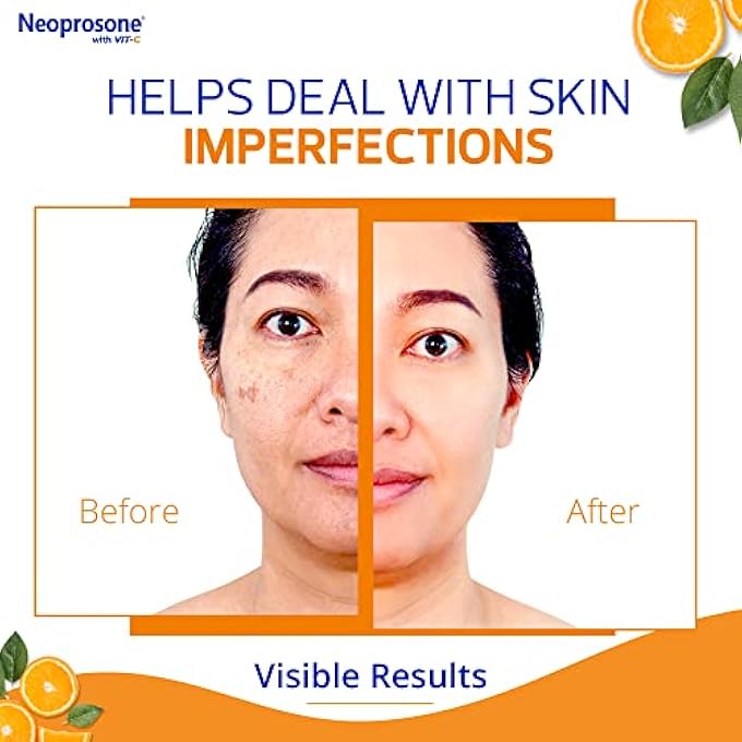 Neoprosone جل كريم تصحيح البقع الداكنة بفيتامين C - 60 مل - Image 4